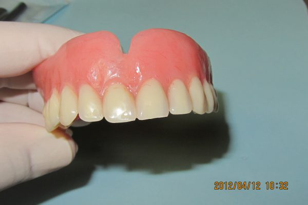 dentures_1